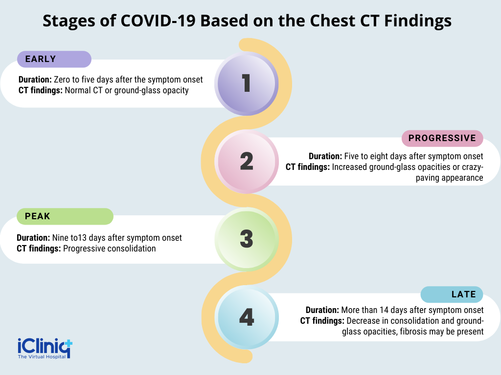 Stages of COVID-19 Based on Chest CT