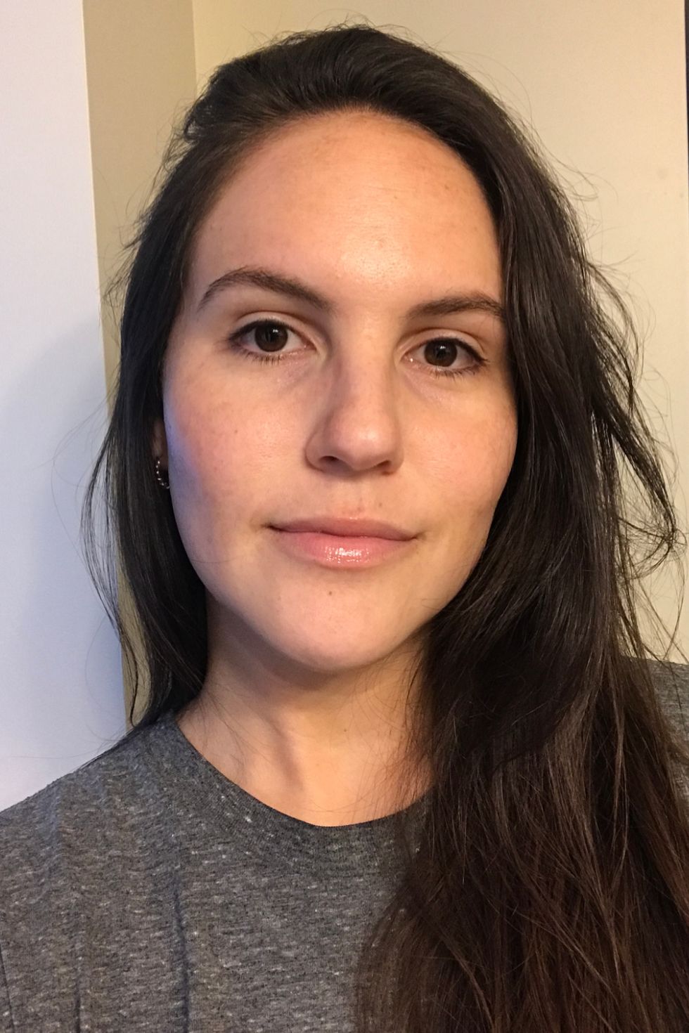 Before Pro Facial