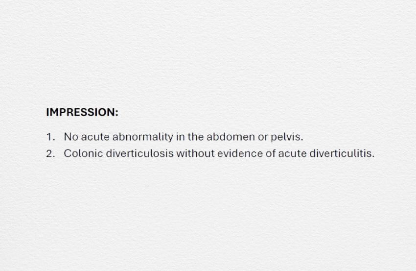 Example of the "impression" section of a radiology report.