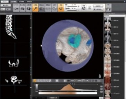 コニカミノルタ：内視鏡手術のシミュレーションにデジタルツインを活用