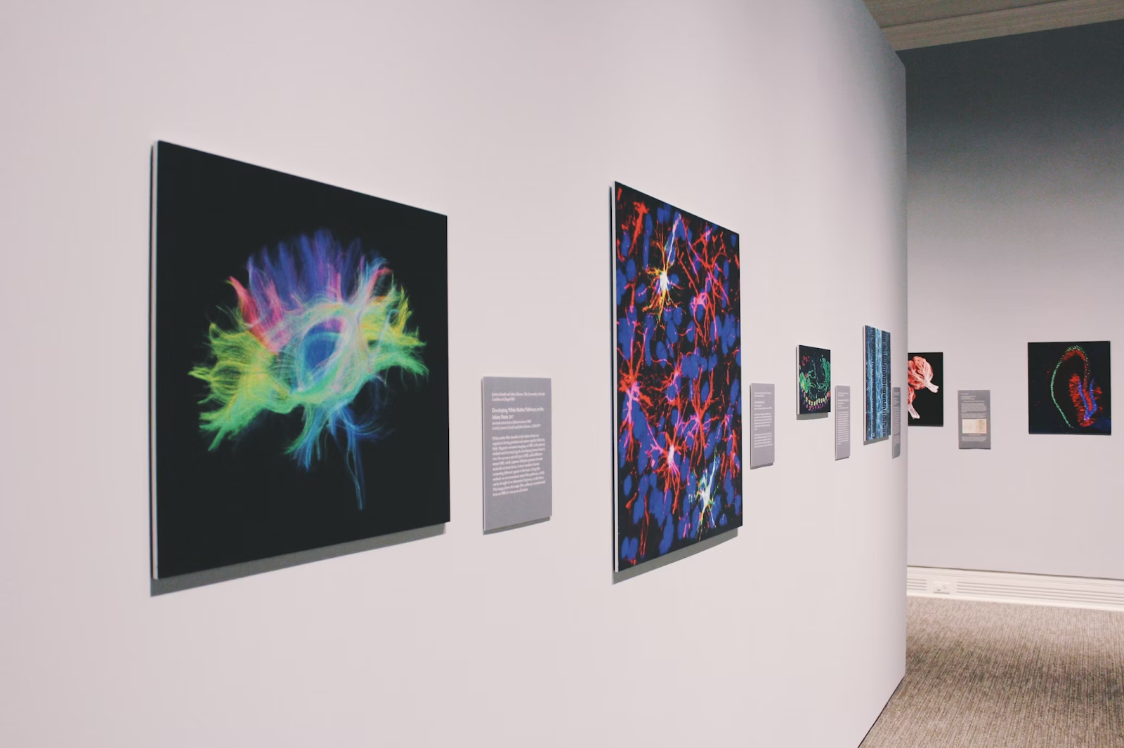 Combination of art and technology to help envision the human brain.