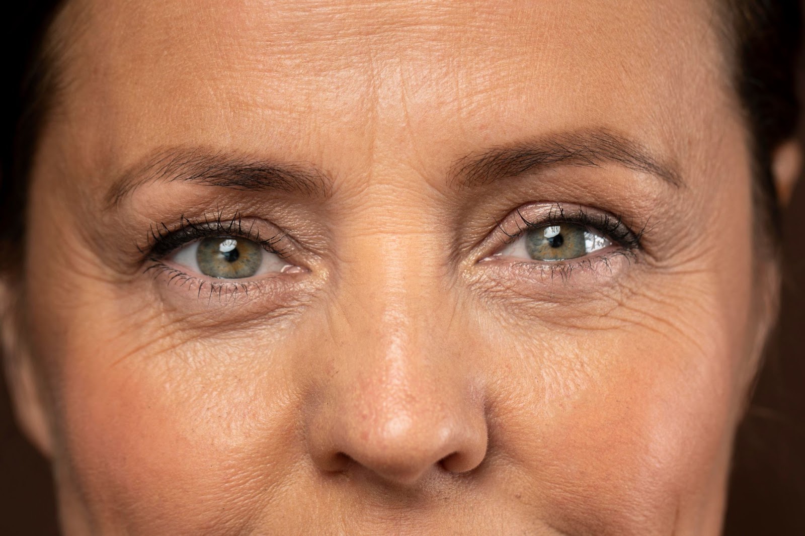 how to get rid of wrinkles on forehead

