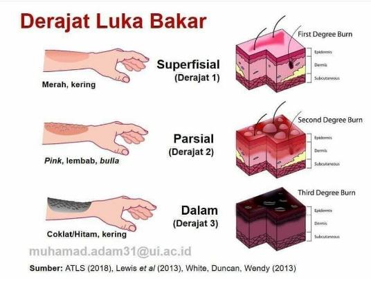 derajat luka bakar