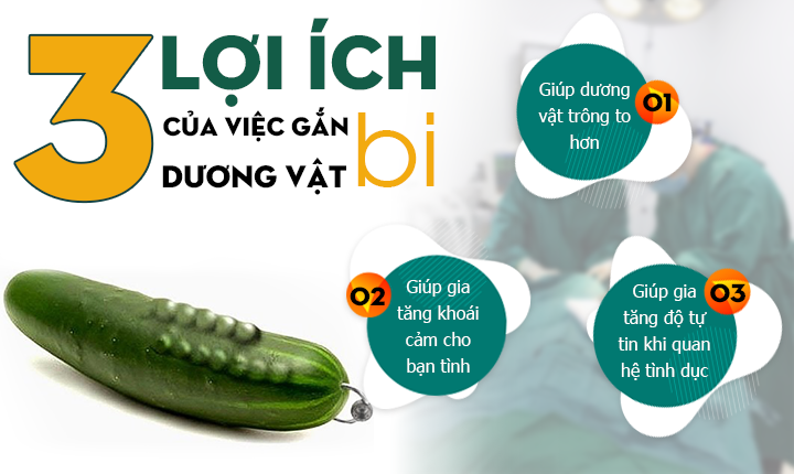 lợi ích khi gắn bi