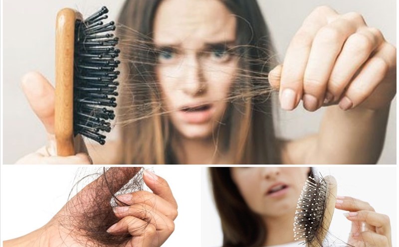 Chăm sóc tóc cho phụ nữ sau sinh