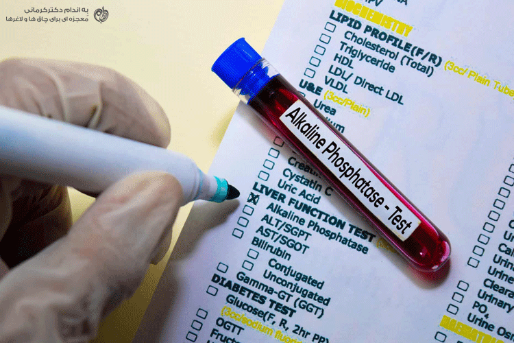فاکتور های مهم تشخیص کبد چرب در آزمایش خون