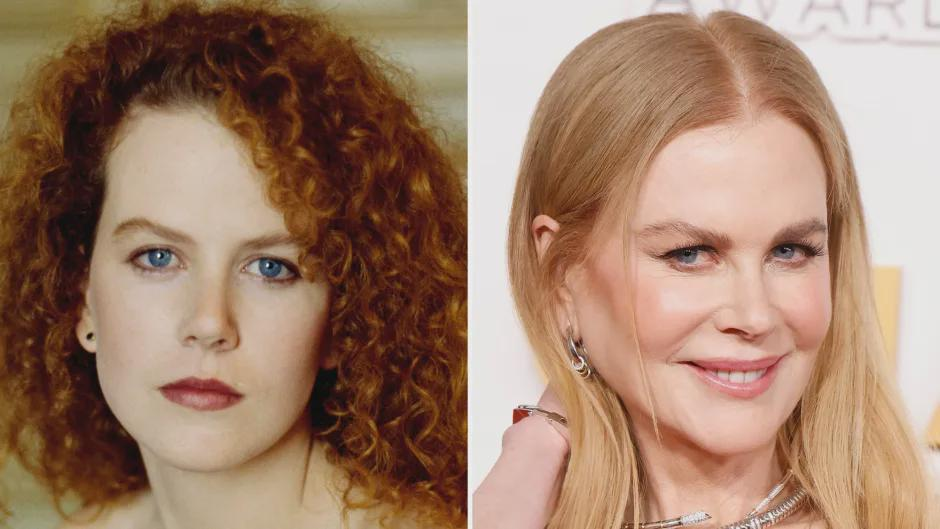 Nicole Kidman Plastic Surgery An Insight into Speculations and Reality