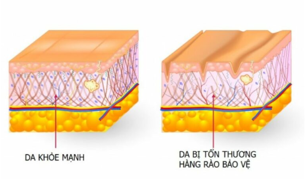 Hàng rào bảo vệ da là gì? Làm thế nào bảo vệ trước ô nhiễm môi trường? - DABO - Mỹ phẩm thiên nhiên Hàn Quốc