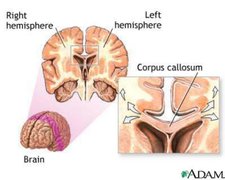 Sperry (Brain)