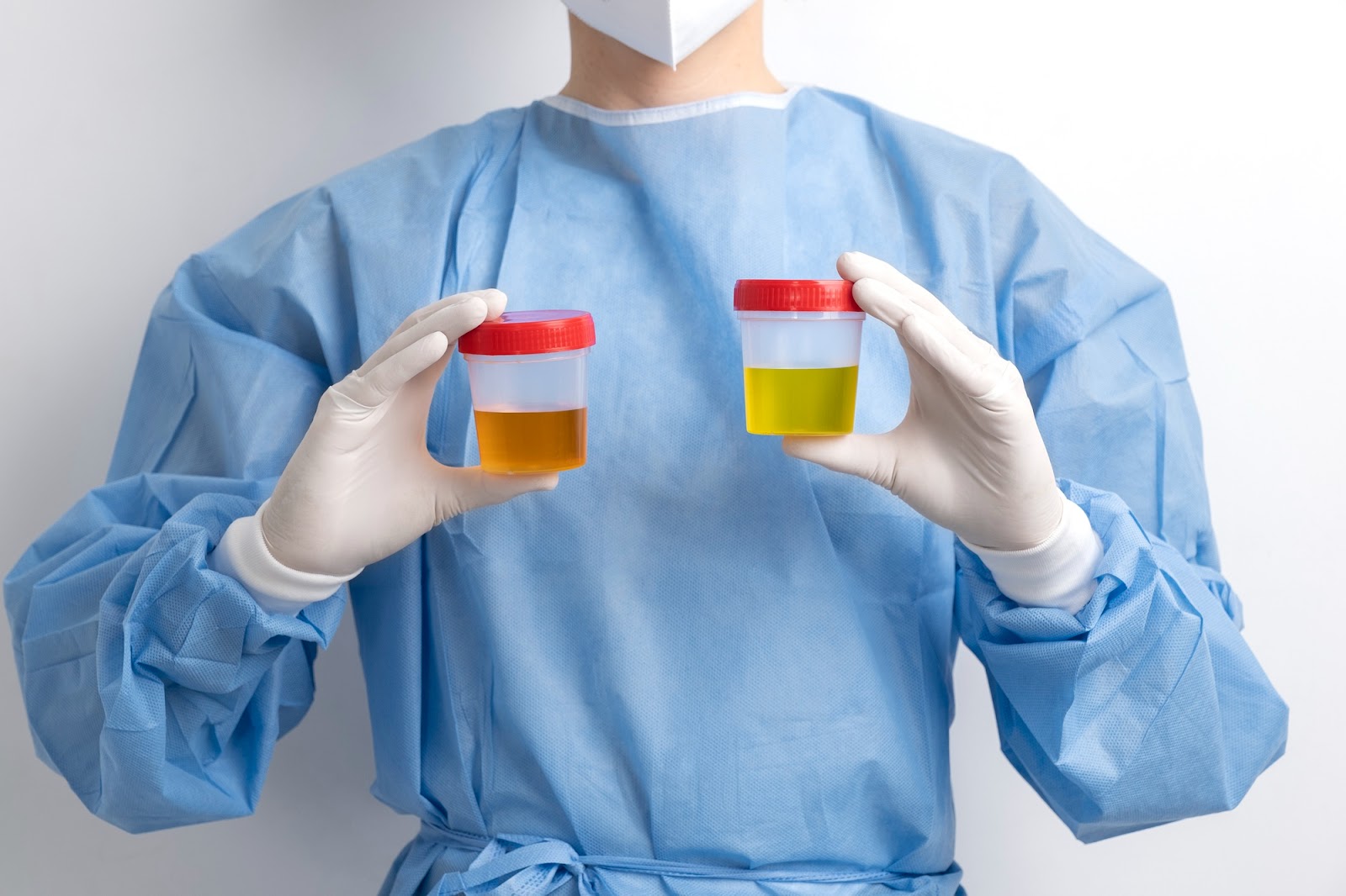 Diagnosticarea cistitei: Cum se stabilește diagnosticul corect