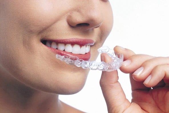 Invisalign dentist in New Westminster