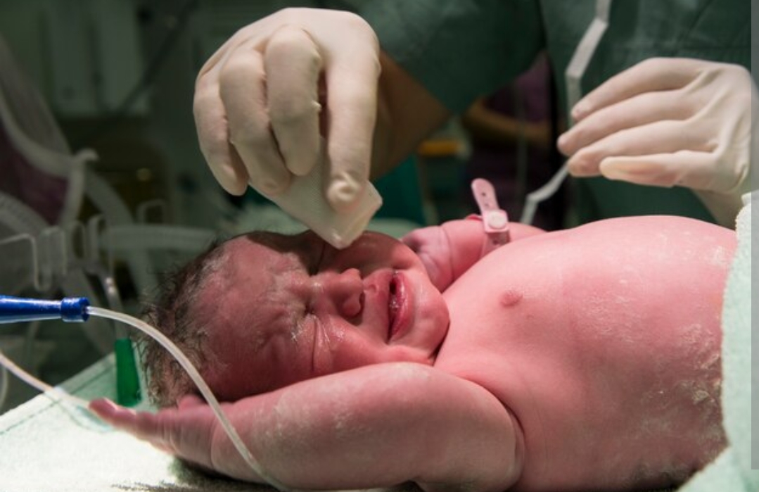 احجزي أفضل عمليات الولادة بدون ألم في مصر