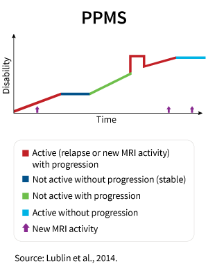 This graphic shows the kinds of disease activity that may occur in PPMS over time.