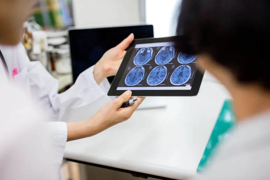 doctors examine a CT scan result, showing a mild brain injury diagnosis.