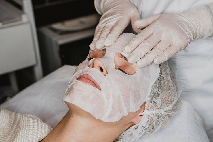 chemical peel treatment