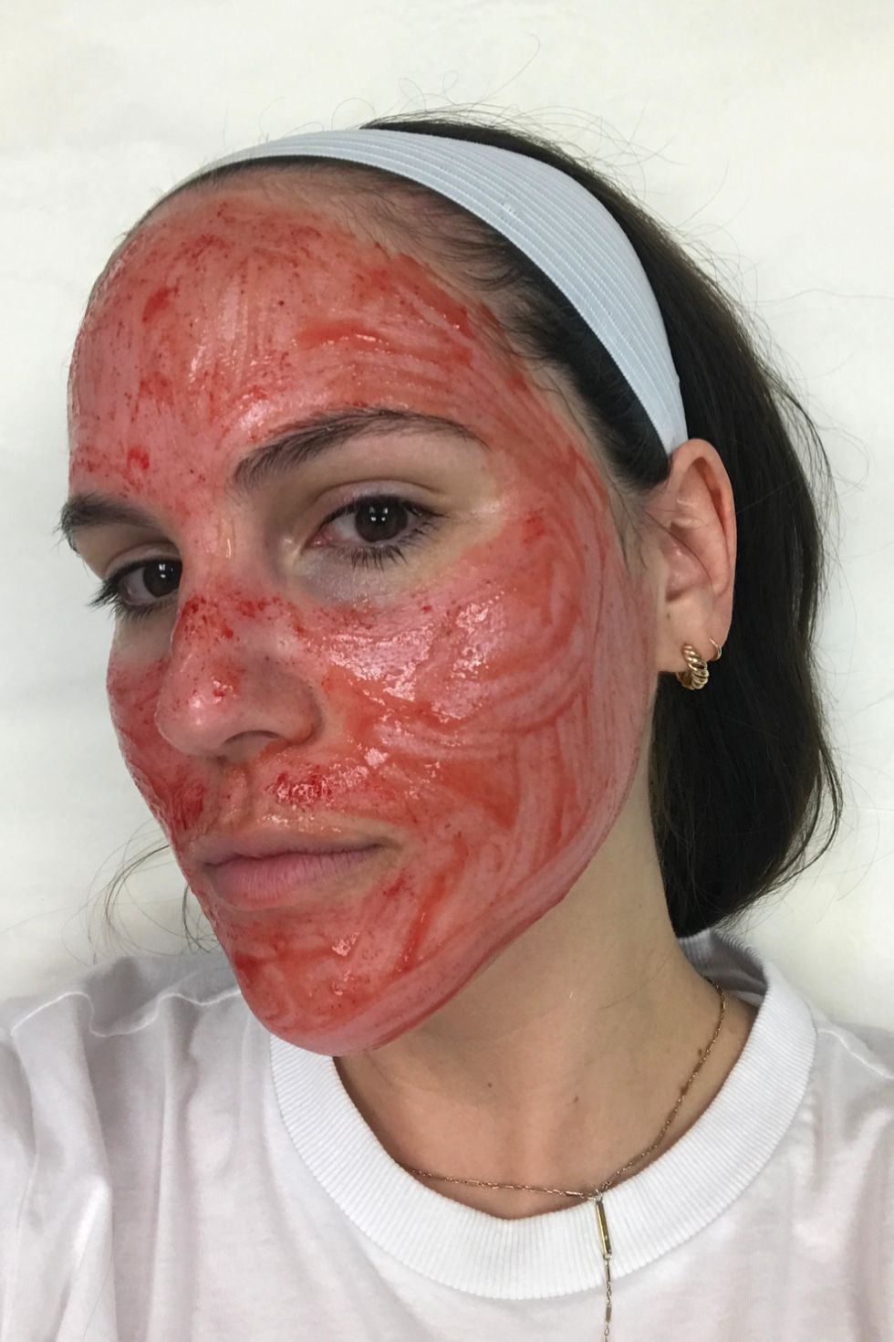 During Pro Facial 2