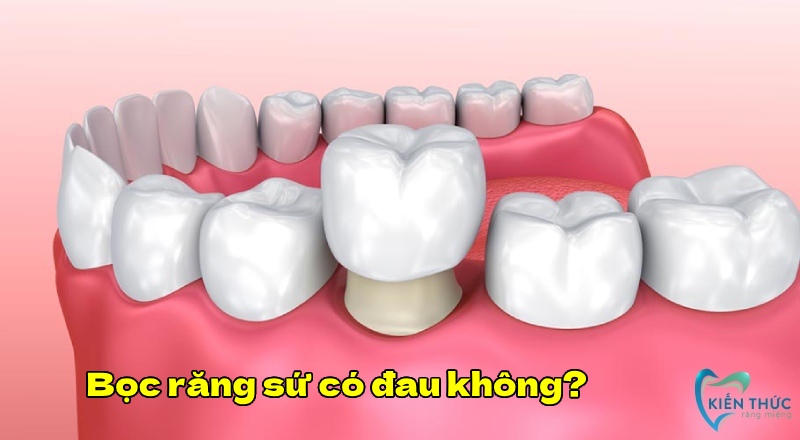 Nhiều người thường lo lắng Bọc răng sứ có đau không