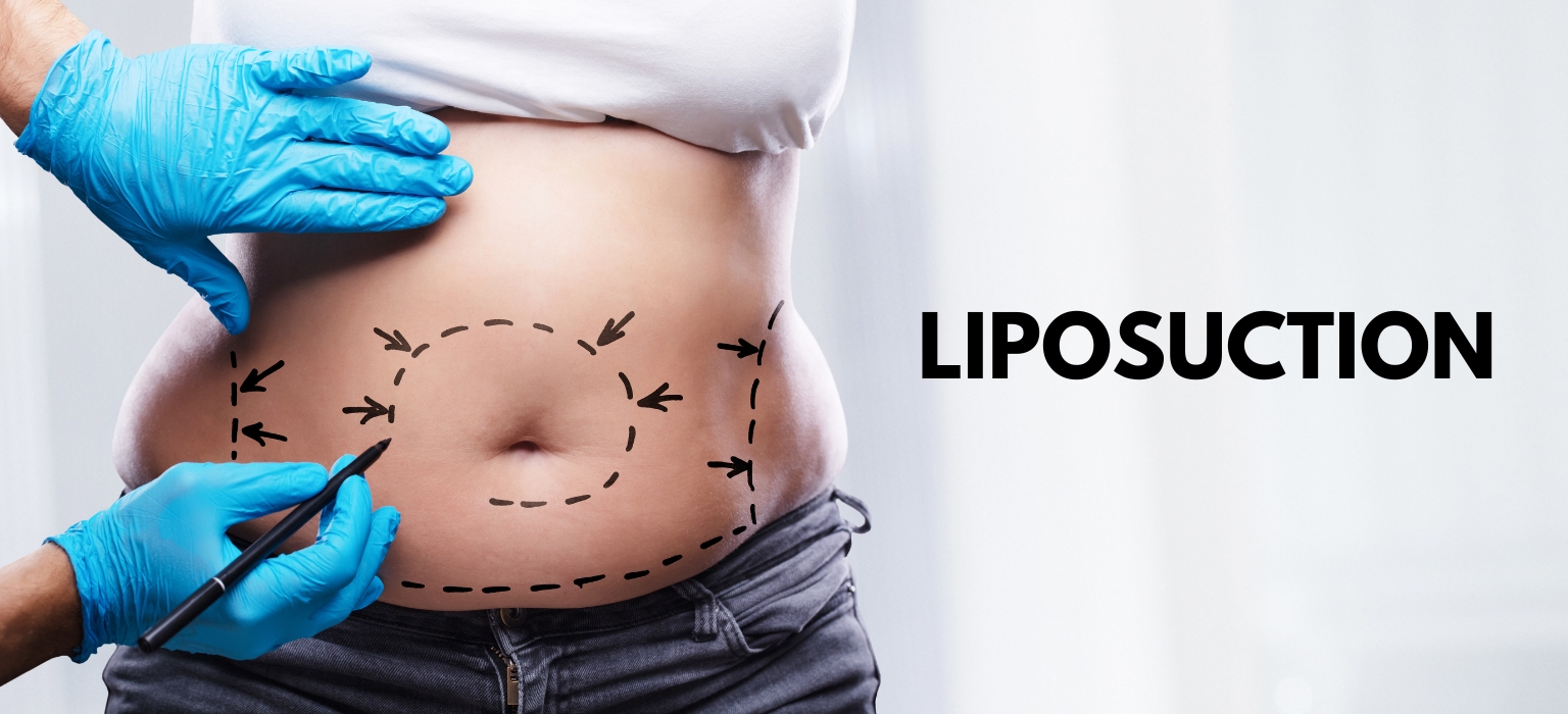 The Top 5 Procedures Performed by a Plastic Surgeon in Miami