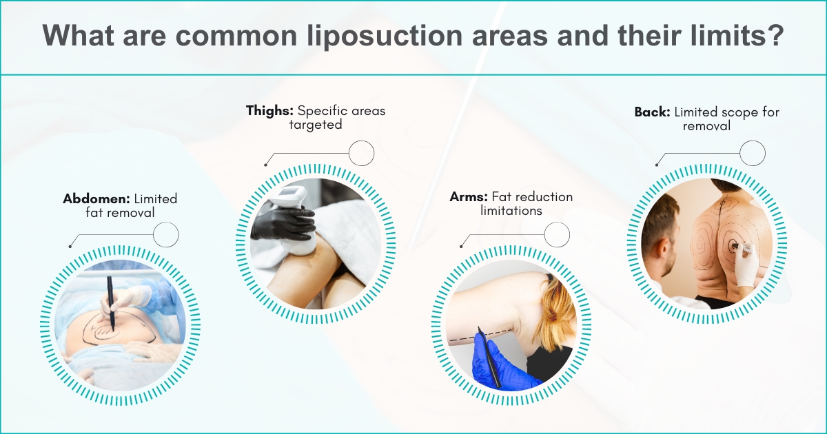 How Much Fat Is Safe To Remove In Liposuction