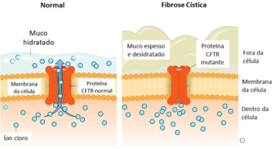 Questão (SOMATÓRIA)A fibrose cística é uma doença hereditária humana  decorrente da mutação no gene que codifica a pro...