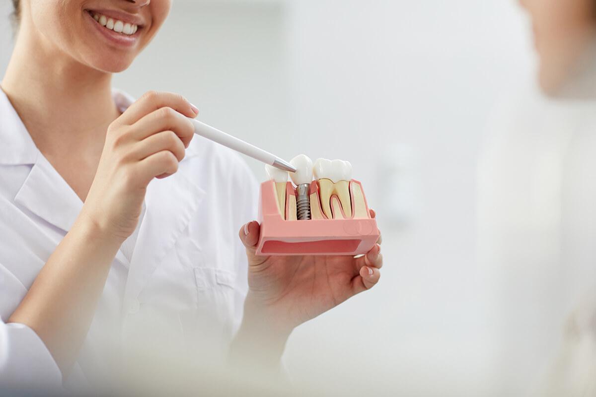 dental implants in Woodbridge