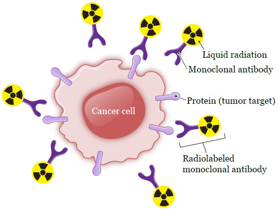 About Your Intrathecal Radioimmunotherapy (RIT) for Pediatric Patients |  Memorial Sloan Kettering Cancer Center