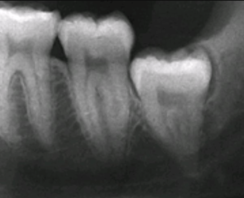 A close-up of teeth

Description automatically generated