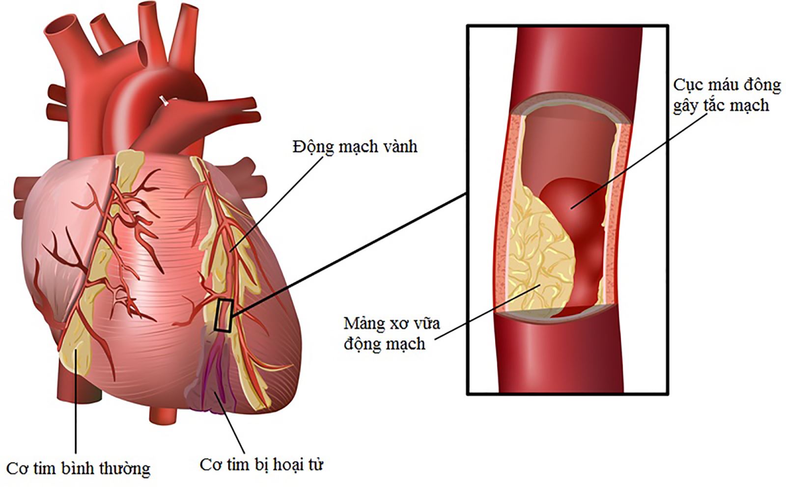 ROI-LOAN-CHUYEN-HOA-LIPID