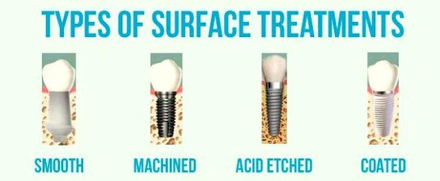 Types of Dental Implants | Quality Dental Care | Adelaide, South Australia
