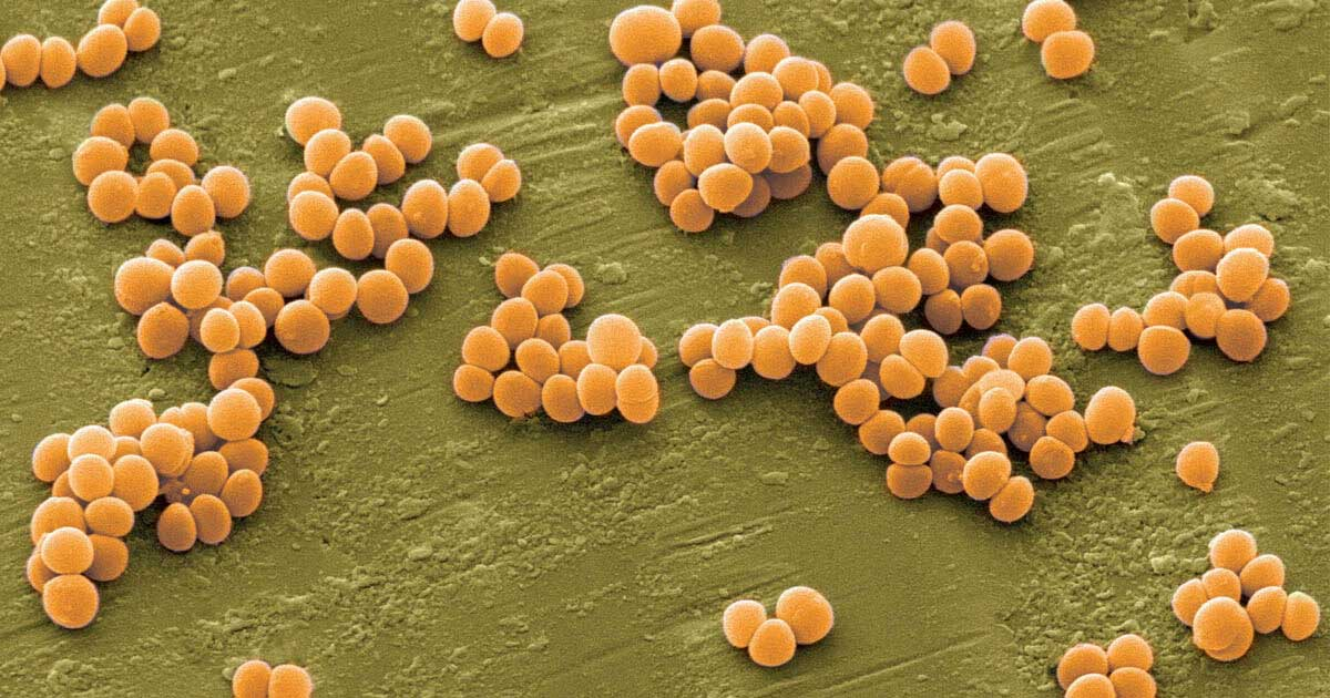 vi-khuan-Staphylococcus-aureus