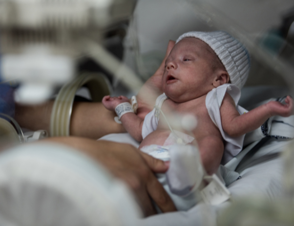 Premature babies often experience episodes of apnea (breathing cessation), which can be managed with medical interventions such as caffeine therapy.