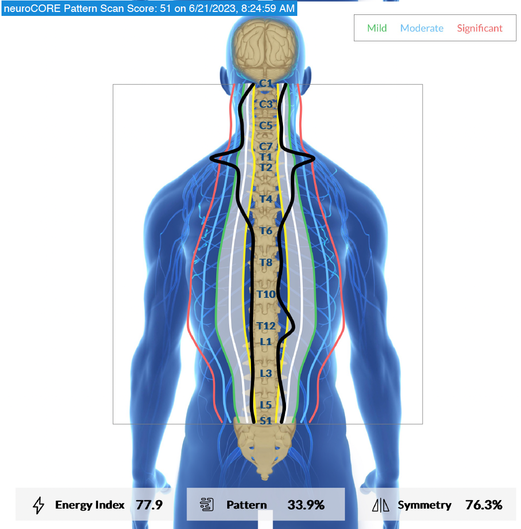 The Roadmap to Chronic Stress + Exhaustion: The 3 Stages of Subluxation | PX Docs