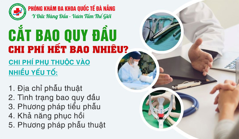 chi-phi-cat-bao-quy-dau-o-da-nang