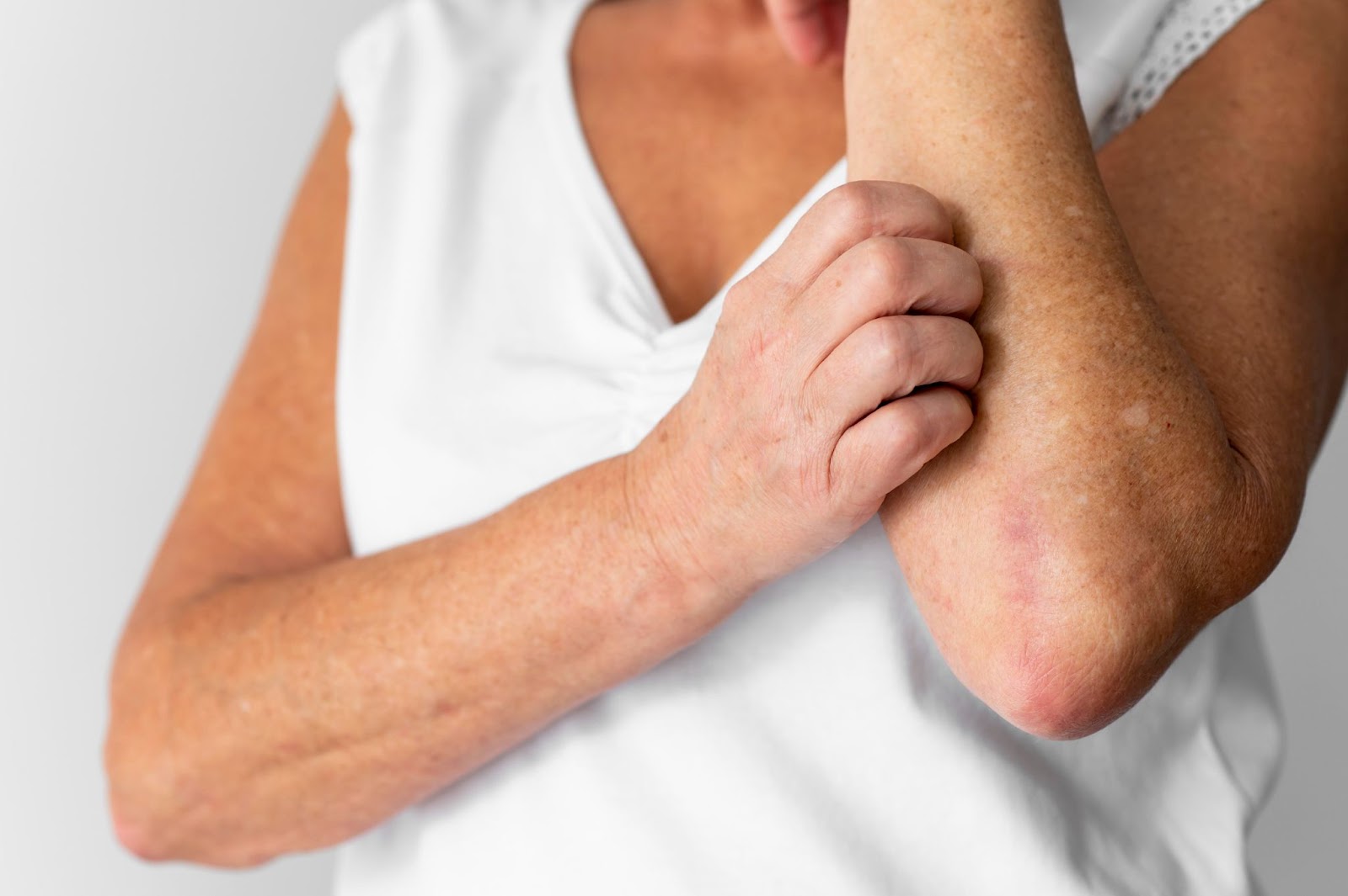 Simptomele dermatitei de contact