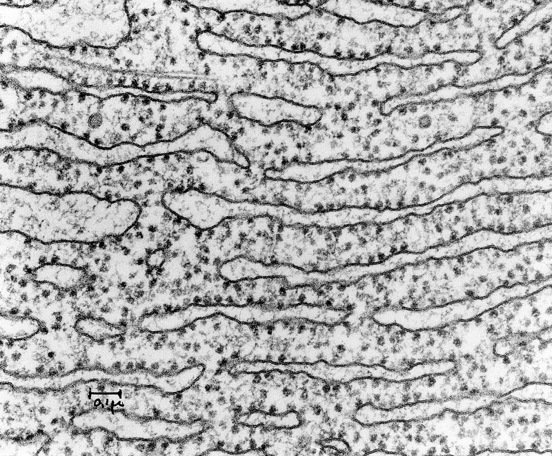 How does rough endoplasmic reticulum differ from smooth endoplasmic  reticulum? | Socratic