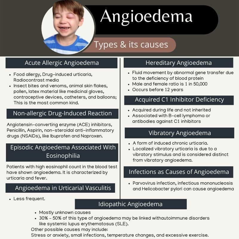types-of-angioedema