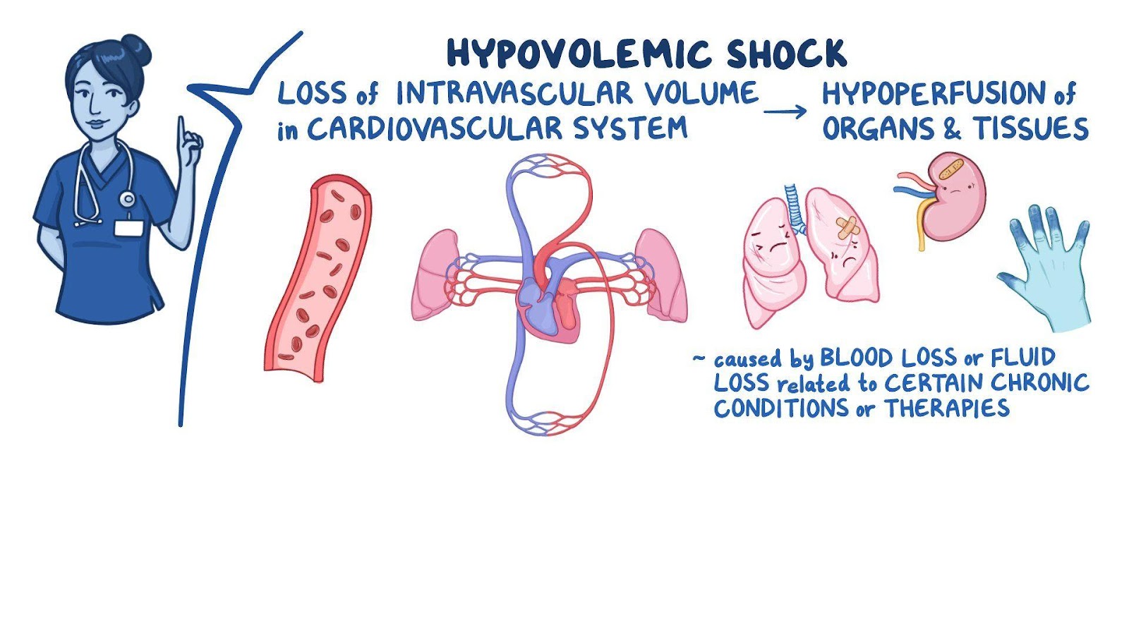 Shock - Hypovolemic: Nursing - Osmosis Video Library