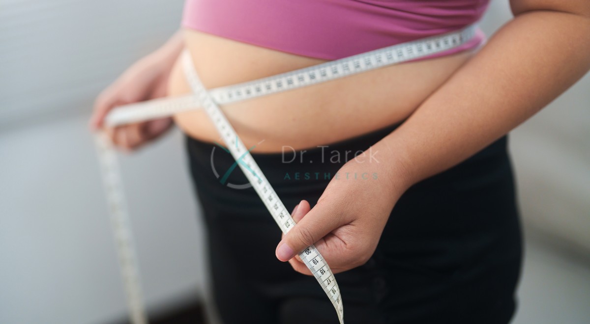 How Much Liposuction Can Be Done With A Tummy Tuck