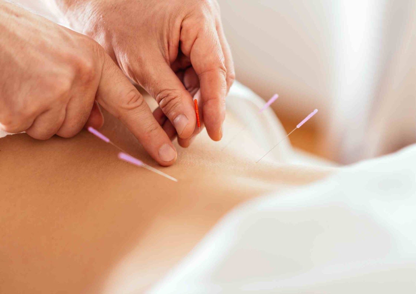 Acupuncture for hormonal balance and fertilityt Malaysia