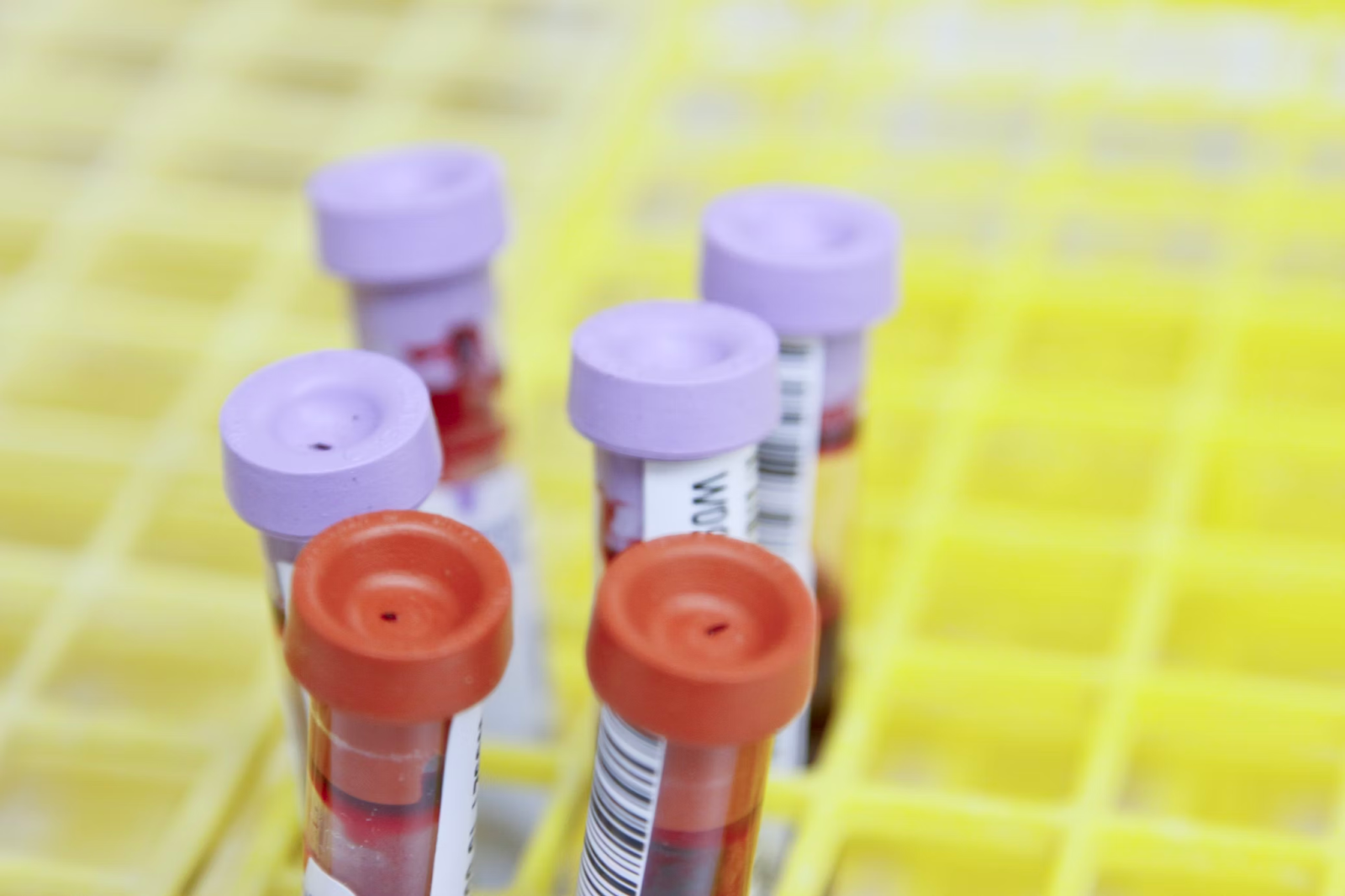 Robotic pipetting systems are advantageous for minimizing human exposure to potentially hazardous substances in the lab.