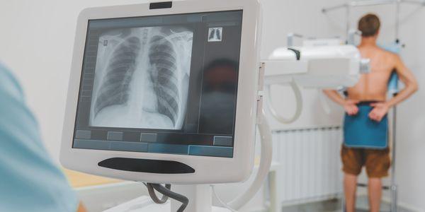 In-Depth Look at Types of X-ray Machines and Their Roles in Your Healthcare  | MedGlobal Group