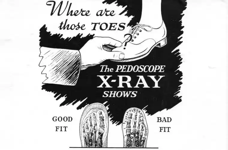 Vintage advertisement showing a hand squeezing a person's foot in a shoe with text "Where are those toes? The Pedoscope X-RAY shows good fit/bad fit" above an illustrated Xray of feet in shoes.