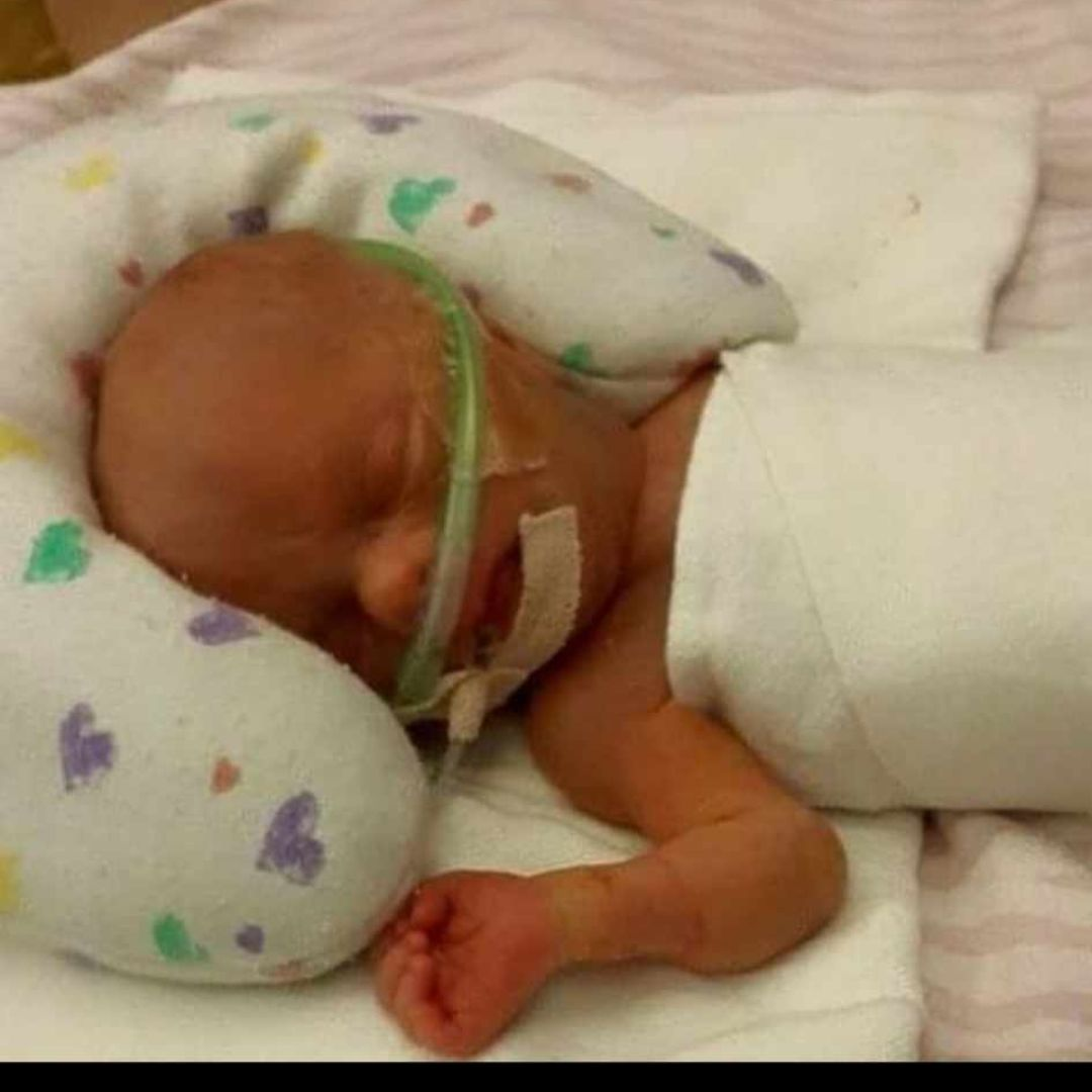 A picture of Caira in the hospital at a few days old.