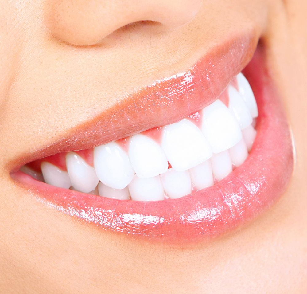 teeth whitening services in Richmond Hill 