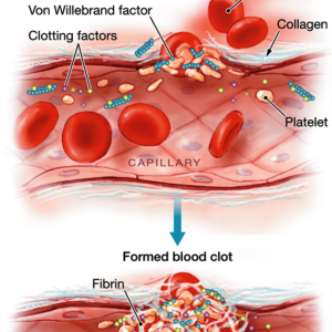 Blood Clotting Disorders