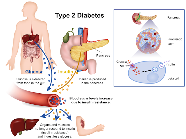 The potential for GLP-1 drugs such as Ozempic and Wegowy, and new anti-cancer and Alzheimer’s drugs to Destroy the Financial Stability (such as it is) of Medicare, Medicaid and the US Healthcare in general. My take as a practicing physician and former pharmaceutical industry researcher. Donald H Marks