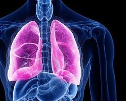 Image of Chronic respiratory diseases