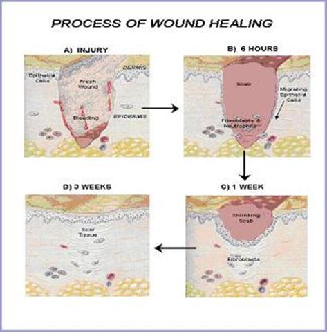 wound-healing-process