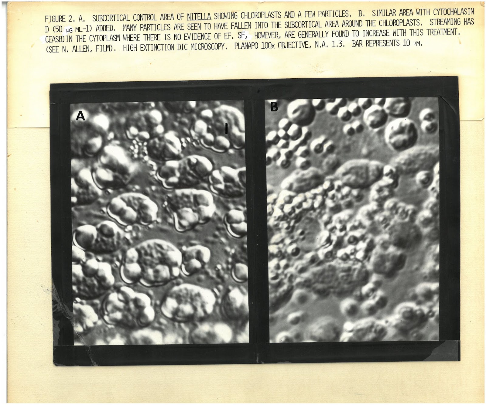 Microscope image of nitella