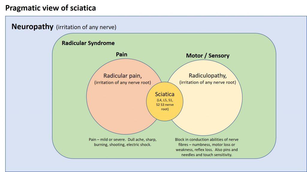 A patient's simple understanding of sciatica, radicular pain and  radiculopathy - Living Well with Pain